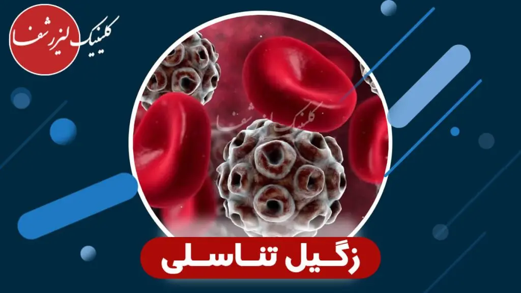 زگیل تناسلی