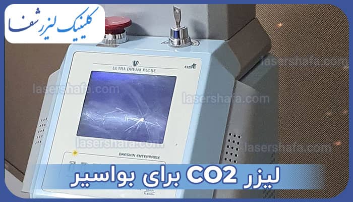 لیزر CO2 برای بواسیر