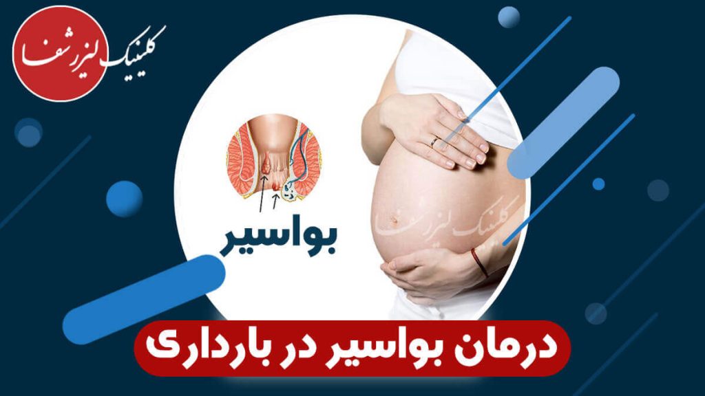 درمان بواسیر در بارداری