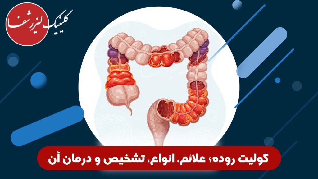 عکس کولیت روده