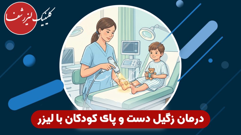 درمان زگیل دست و پای کودکان با لیزر