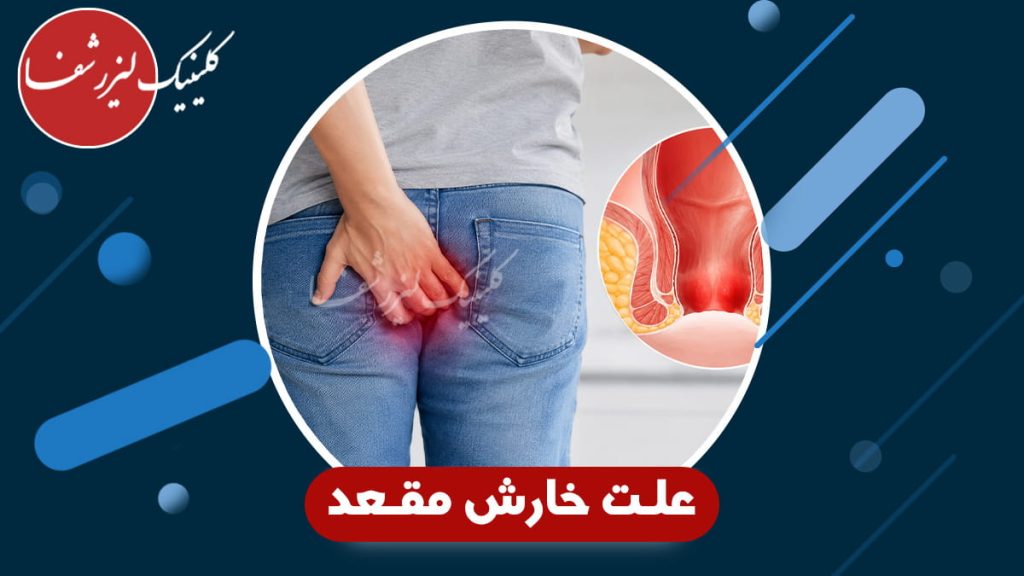 تشخیص علت خارش مقعد چگونه انجام میشود؟
