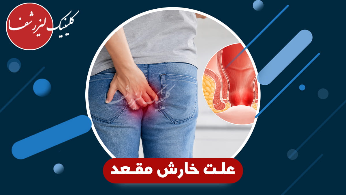 تشخیص علت خارش مقعد چگونه انجام می‌شود؟