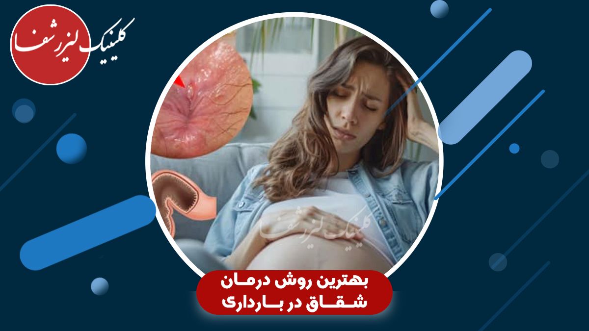 علت شقاق در بارداری چیست؟